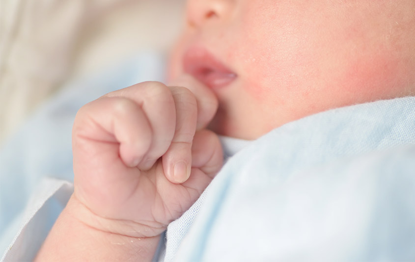 aceite de oliva para la costra lactea del bebe